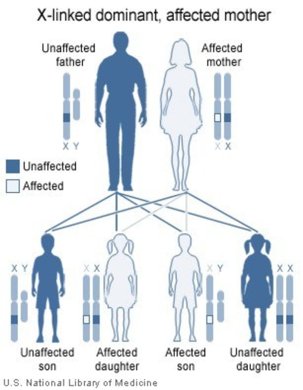 Diagramm eines X-chromosomal dominanten Familienstammbaums mit betroffener Mutter und erklärendem Text.